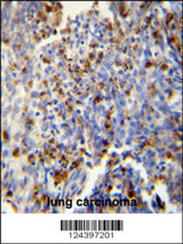 FOSL2 Antibody (Center)