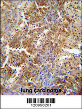 ERCC8 Antibody (Center)