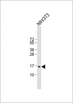 CDKN2C Antibody (C-term)