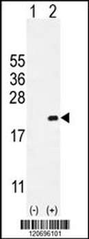 CDKN2C Antibody (C-term)