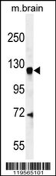 CENTG1 Antibody (C-term)