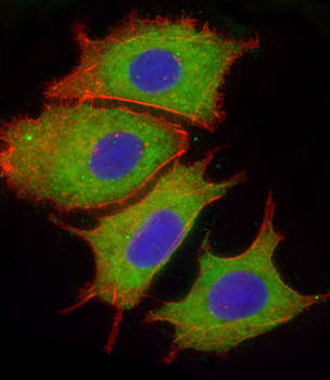 CFH Antibody (Center)