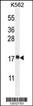 RPL27A Antibody (C-term)