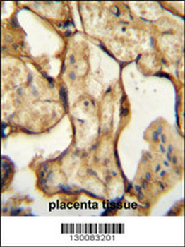 CSH1 Antibody (C-term)