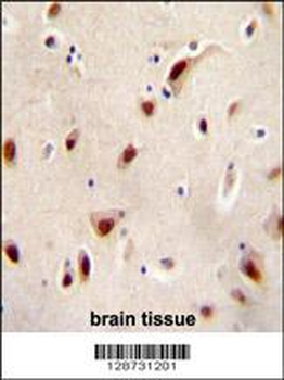 IQCJ Antibody (C-term)