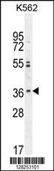 OR2M3 Antibody (C-term)