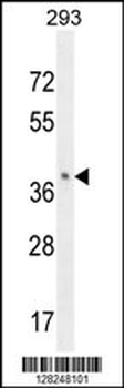 OR8B8 Antibody (C-term)