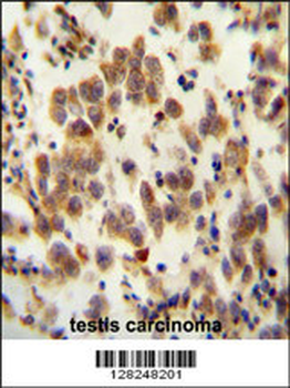 OR8B8 Antibody (C-term)