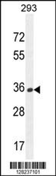OR10H1 Antibody (C-term)