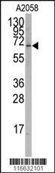 RORA Antibody (T216)
