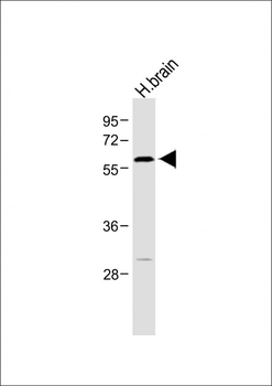 RORA Antibody (T216)