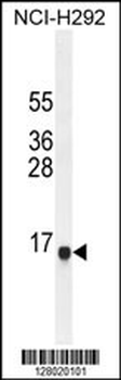 SPAG11A Antibody (N-term)