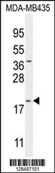 CT173 Antibody (Center)