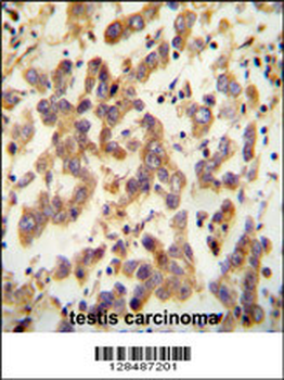 CT173 Antibody (Center)