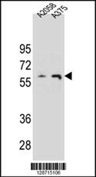 THUM3 Antibody (Center)