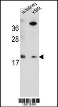 RN185 Antibody (Center)
