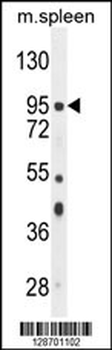 NSUN2 Antibody (Center)