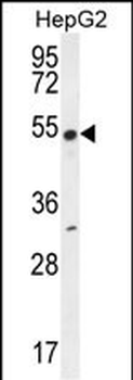 CR1L Antibody (C-term)