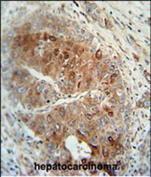 CR1L Antibody (C-term)