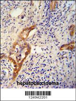 CLPX Antibody (C-term)