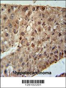 ZC4H2 Antibody (C-term)