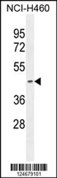 PDHA2 Antibody (Center)