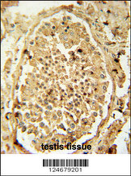 PDHA2 Antibody (Center)