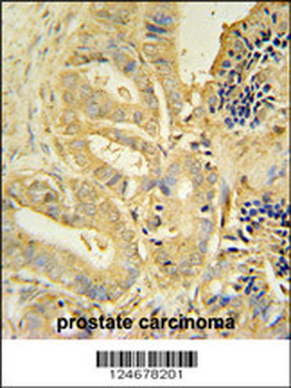 TLL1 Antibody (C-term)