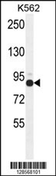 ZNF366 Antibody (C-term)