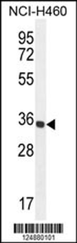 PRSS1 Antibody (Center)