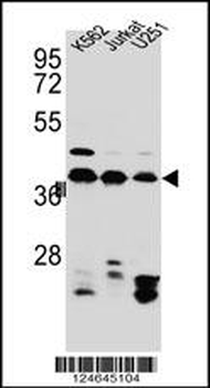 HNRNPC Antibody (C-term)