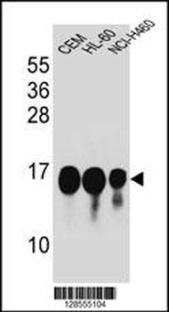 HIST1H2BJ Antibody (Center)