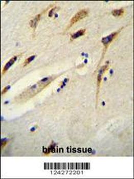BEX1 Antibody (Center)