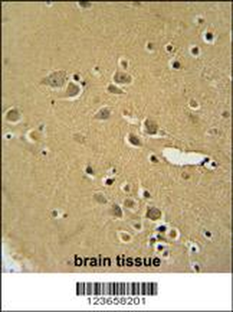 AMY2B Antibody (N-term)