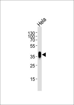 FOLR1 Antibody (N-term)