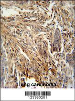 CSF2 Antibody (Center)