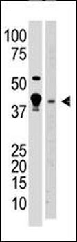 MBD2 Antibody (N-term)