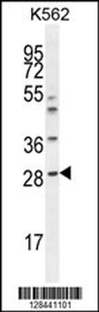 APCS Antibody (C-term)