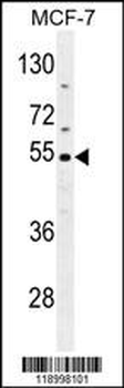 CES2 Antibody (Center)