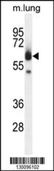 ZUFSP Antibody (N-term)