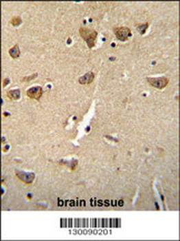 CPLX3 Antibody (Center)