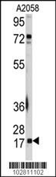 UBC9 (UBE2I) Antibody (N-term)