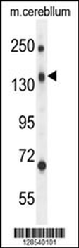 CD109 Antibody (N-term)