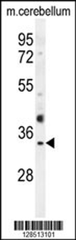 OR51I1 Antibody (C-term)