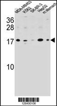 S100Z Antibody (N-term)