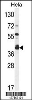 DEGS2 Antibody (C-term)