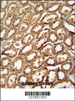 DEGS2 Antibody (C-term)