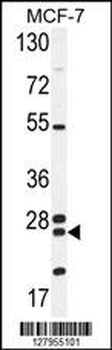 NUDT8 Antibody (N-term)