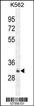 OR52A1 Antibody (C-term)