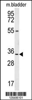 LRC18 Antibody (C-term)